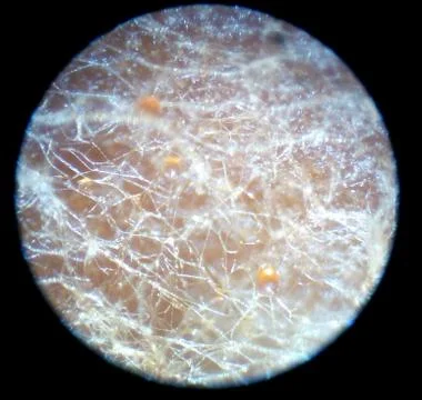 Peanuts under the microscope under the increase of spoiled mycotoxins fungi mold Stock Photos