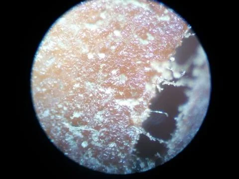 Peanuts under the microscope under the increase of spoiled mycotoxins fungi mold Stock Photos