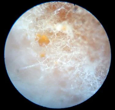 Peanuts under the microscope under the increase of spoiled mycotoxins fungi mold Stock Photos