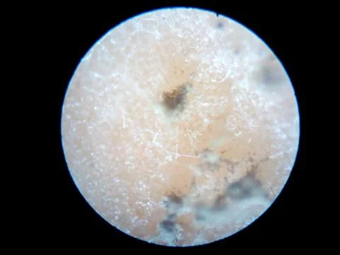 Peanuts under the microscope under the increase of spoiled mycotoxins fungi mold Stock Photos