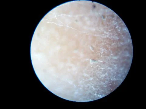 Peanuts under the microscope under the increase of spoiled mycotoxins fungi mold Foto stock