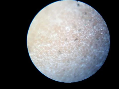 Peanuts under the microscope under the increase of spoiled mycotoxins fungi mold Stock Photos