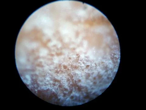 Peanuts under the microscope under the increase of spoiled mycotoxins fungi mold Stock-Fotos