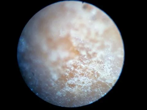 Peanuts under the microscope under the increase of spoiled mycotoxins fungi mold Stock Photos