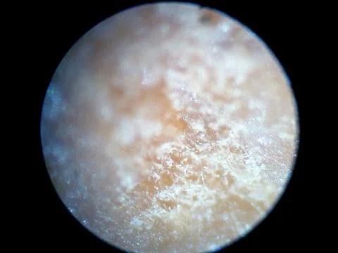 Peanuts under the microscope under the increase of spoiled mycotoxins fungi mold Stock Photos