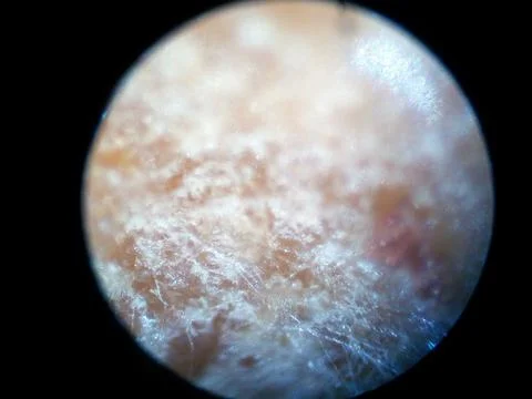 Peanuts under the microscope under the increase of spoiled mycotoxins fungi mold Stock Photos