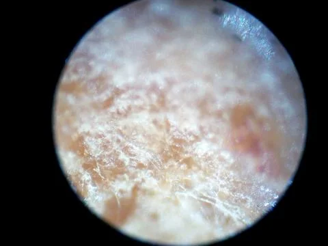 Peanuts under the microscope under the increase of spoiled mycotoxins fungi mold Foto stock