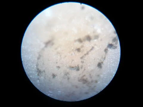 Peanuts under the microscope under the increase of spoiled mycotoxins fungi mold Stock Photos