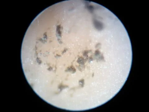 Peanuts under the microscope under the increase of spoiled mycotoxins fungi mold Stock-Fotos