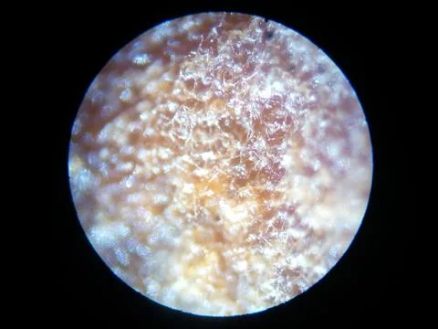 Peanuts under the microscope under the increase of spoiled mycotoxins fungi mold Stock Photos