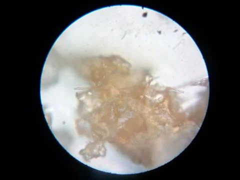 Peanuts under the microscope under the increase of spoiled mycotoxins fungi mold Stock Photos