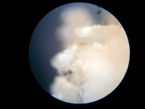 Peanuts under the microscope under the increase of spoiled mycotoxins fungi mold Stock Photos