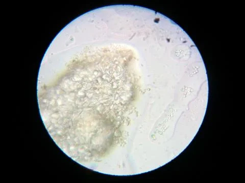 Peanuts under the microscope under the increase of spoiled mycotoxins fungi mold Stock Photos