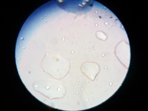 Peanuts under the microscope under the increase of spoiled mycotoxins fungi mold Stock Photos