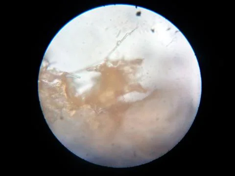 Peanuts under the microscope under the increase of spoiled mycotoxins fungi mold Stock Photos