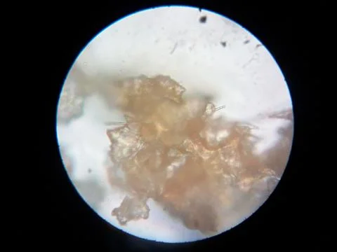 Peanuts under the microscope under the increase of spoiled mycotoxins fungi mold Stock Photos