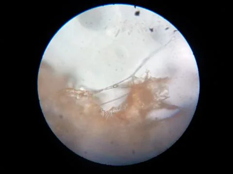 Peanuts under the microscope under the increase of spoiled mycotoxins fungi mold Stock Photos