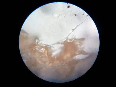 Peanuts under the microscope under the increase of spoiled mycotoxins fungi mold Foto stock