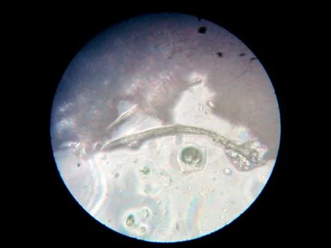 Peanuts under the microscope under the increase of spoiled mycotoxins fungi mold Stock Photos