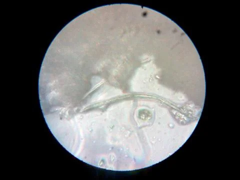 Peanuts under the microscope under the increase of spoiled mycotoxins fungi mold Foto stock