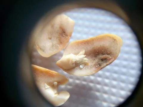 Peanuts under the microscope under the increase of spoiled mycotoxins fungi mold Stock Photos