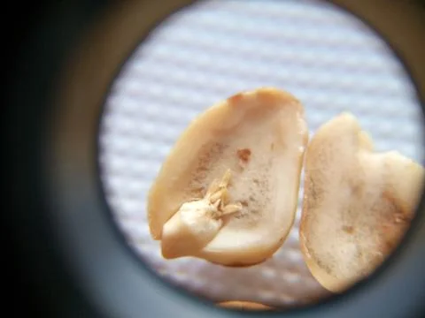 Peanuts under the microscope under the increase of spoiled mycotoxins fungi mold Stock Photos