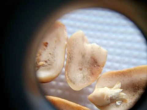 Peanuts under the microscope under the increase of spoiled mycotoxins fungi mold Stock Photos