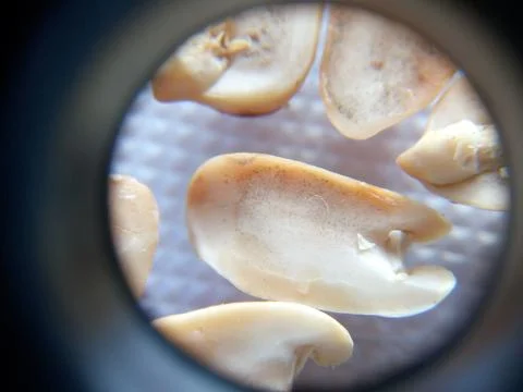 Peanuts under the microscope under the increase of spoiled mycotoxins fungi mold Stock Photos