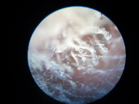 Peanuts under the microscope under the increase of spoiled mycotoxins fungi mold Stock Photos