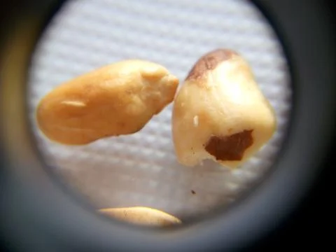 Peanuts under the microscope under the increase of spoiled mycotoxins fungi mold Stock Photos