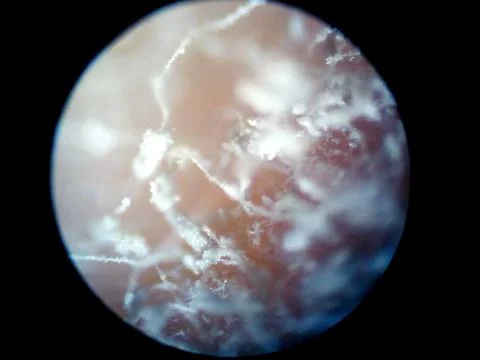 Peanuts under the microscope under the increase of spoiled mycotoxins fungi mold Stock Photos