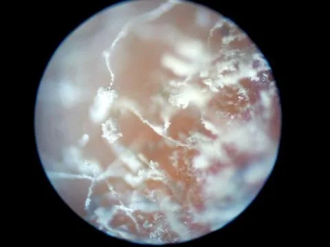 Peanuts under the microscope under the increase of spoiled mycotoxins fungi mold Stock Photos