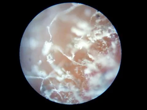 Peanuts under the microscope under the increase of spoiled mycotoxins fungi mold Stock Photos