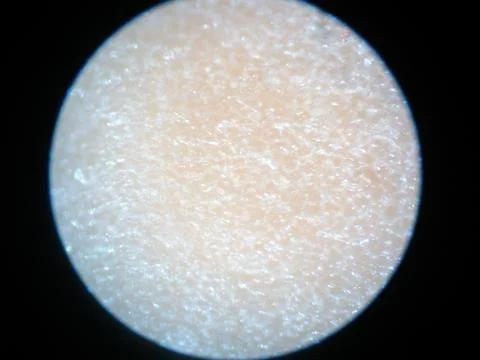 Peanuts under the microscope under the increase of spoiled mycotoxins fungi mold Stock Photos