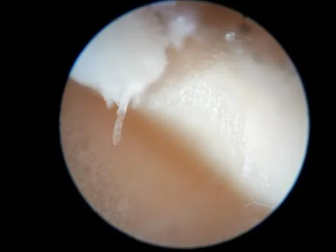 Peanuts under the microscope under the increase of spoiled mycotoxins fungi mold Stock-Fotos