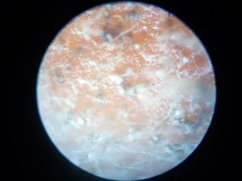 Peanuts under the microscope under the increase of spoiled mycotoxins fungi mold Foto stock