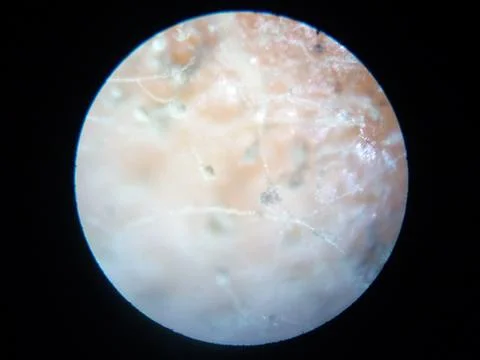 Peanuts under the microscope under the increase of spoiled mycotoxins fungi mold Foto stock