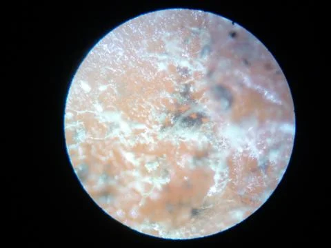 Peanuts under the microscope under the increase of spoiled mycotoxins fungi mold Stock Photos