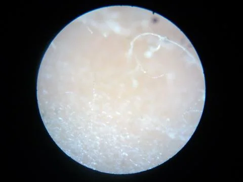 Peanuts under the microscope under the increase of spoiled mycotoxins fungi mold Stock Photos