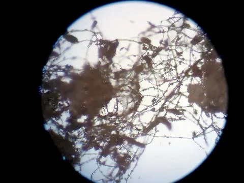 Peanuts under the microscope under the increase of spoiled mycotoxins fungi mold Stock Photos