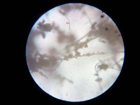 Peanuts under the microscope under the increase of spoiled mycotoxins fungi mold Stock Photos