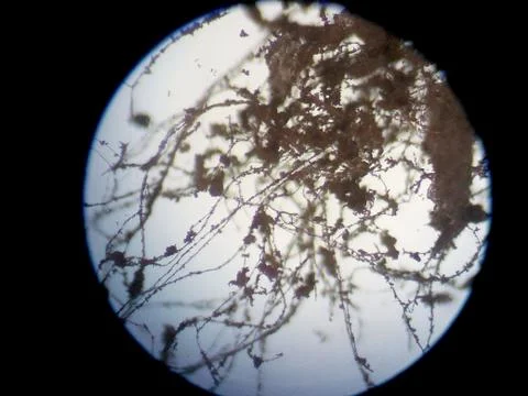 Peanuts under the microscope under the increase of spoiled mycotoxins fungi mold Stock Photos