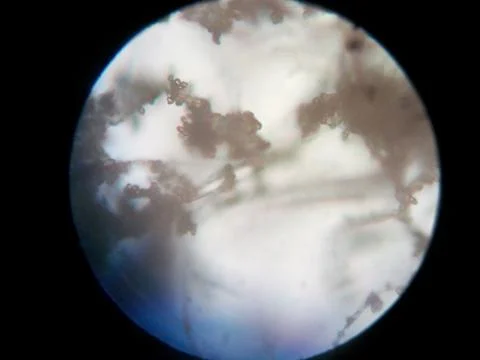 Peanuts under the microscope under the increase of spoiled mycotoxins fungi mold Stock Photos