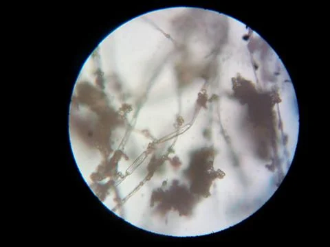 Peanuts under the microscope under the increase of spoiled mycotoxins fungi mold Stock Photos