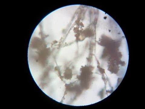 Peanuts under the microscope under the increase of spoiled mycotoxins fungi mold Stock Photos