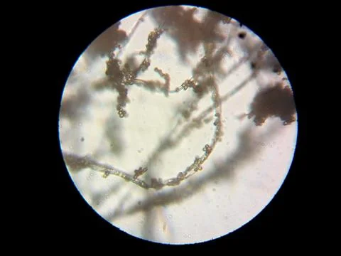 Peanuts under the microscope under the increase of spoiled mycotoxins fungi mold Stock Photos