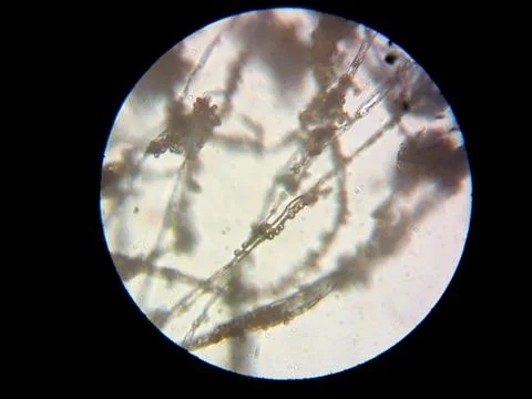 Peanuts under the microscope under the increase of spoiled mycotoxins fungi mold Stock-Fotos