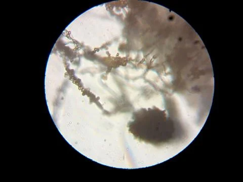 Peanuts under the microscope under the increase of spoiled mycotoxins fungi mold Stock Photos