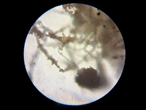 Peanuts under the microscope under the increase of spoiled mycotoxins fungi mold Stock Photos