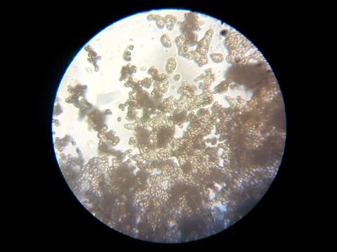 Peanuts under the microscope under the increase of spoiled mycotoxins fungi mold Foto stock